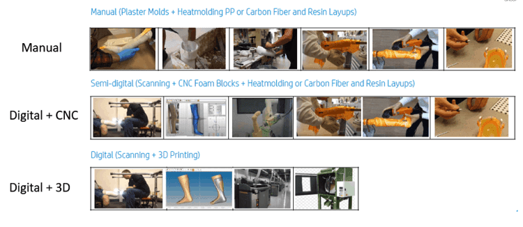 Process of Personalised Orthotics Manufacturing